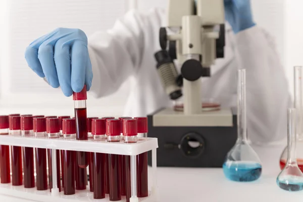 BLOOD SAMPLE