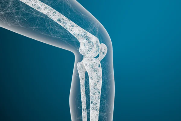 Osteoporosis