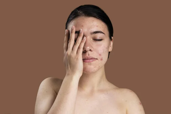 Skin Diseases