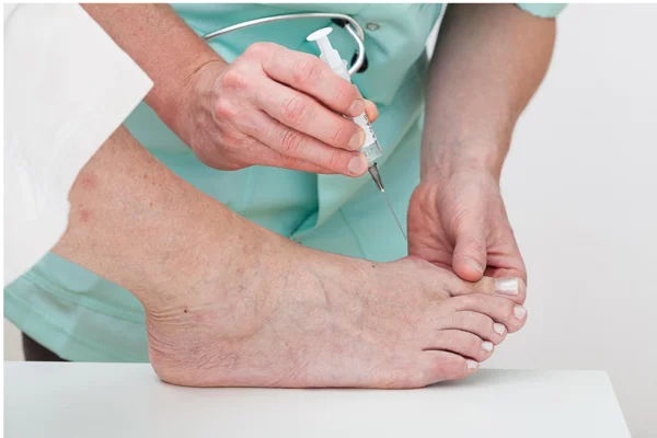 Diabetes Foot Management